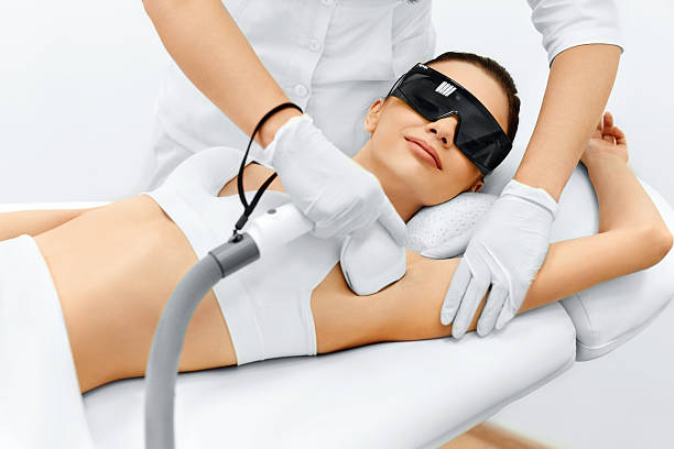 épilation définitive au laser