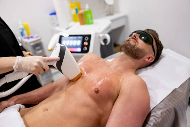 épilation définitive au laser