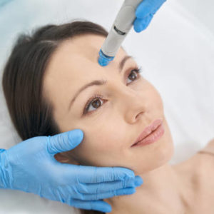 L’hydrafacial à Lyon est-il efficace contre le teint terne et les irrégularités cutanées ?