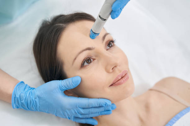 L’hydrafacial à Lyon est-il efficace contre le teint terne et les irrégularités cutanées ?